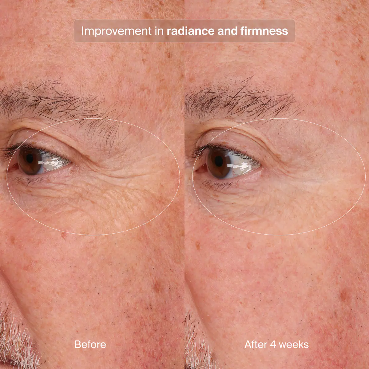 Before and after comparison of a man's eyes showing improvement in radiance and firmness after 4 weeks.